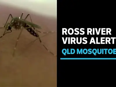 Ross River Fever causes symptoms and prevention tips