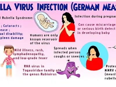 Rubella (German Measles) causes symptoms and prevention