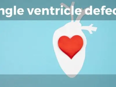 Understanding Single Ventricle Defects Symptoms And Causes