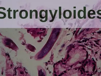 Who is at risk for strongyloidiasis hyperinfection syndrome?