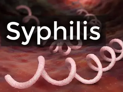 Syphilis explained - The importance of early syphilis testing