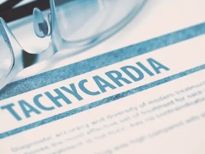 Understanding tachycardia sinus tachycardia symptoms fast