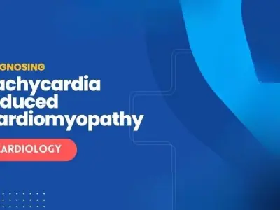 Early warning Tachycardia-Induced Cardiomyopathy explained
