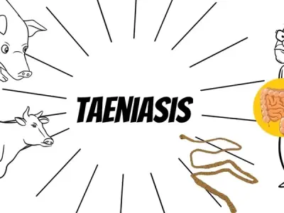 Taeniasis - Understanding the human tapeworm infection