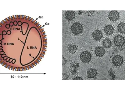Understanding Tahyna Virus Infection and its symptoms