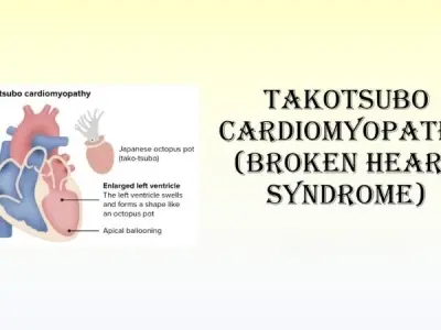 Causes of Takotsubo Cardiomyopathy (Broken Heart Syndrome)