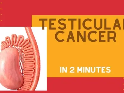 Testicular cancer - The most common cancer in young men