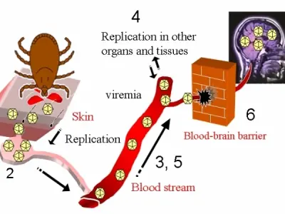 Tick-borne encephalitis (TBE) symptoms and prevention tips