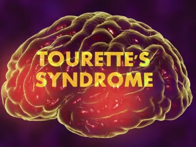 Tourette syndrome - Understanding the tics and treatments