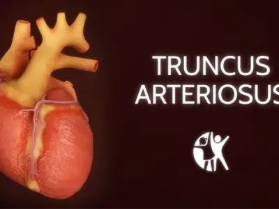 Early diagnosis of Truncus Arteriosus saves your life