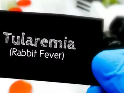 Recognizing the ulcer and swollen glands of tularemia