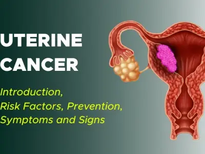 Uterine Cancer - Recognizing postmenopausal bleeding