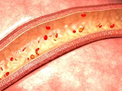 Recognizing the skin rash and signs of vasculitis