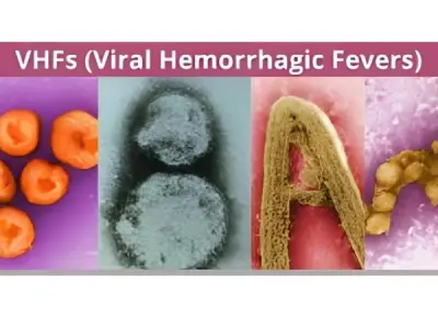 Understanding venezuelan hemorrhagic fever and risks