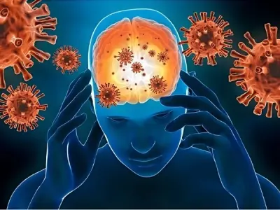 Viral encephalitis explained key facts you must know