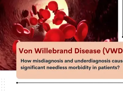 Diagnosing the different types of Von Willebrand disease
