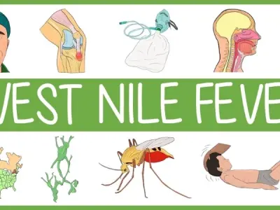 West nile fever - Symptoms, causes, and prevention tips