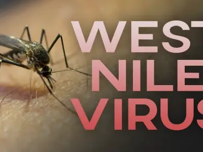 West nile virus infection - Symptoms and risks
